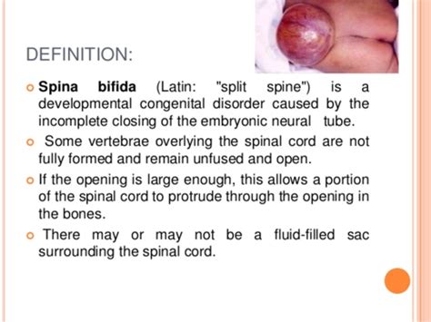 When the neural tube doesnt close all the way, the backbone that protects the spinal cord doesnt form and close. . Spina bifida is defined as quizlet